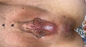Creampie Photoset