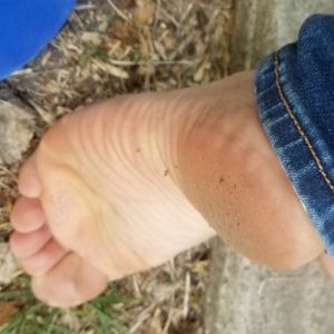 Dirty feet