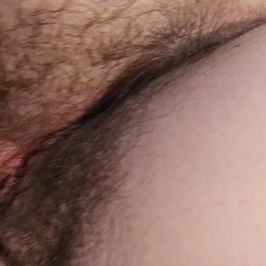 HAIRY CUNT AND ASS PHOTOSET