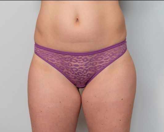 Purple Lace Thong