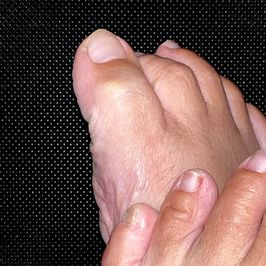 Raw unfiltered real mature feet