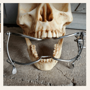 Medical Mouth Gag