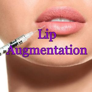 lip augmentation