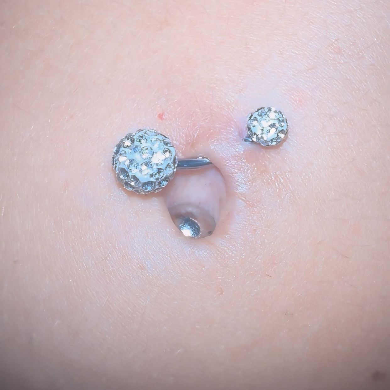 Bellybutton insertions
