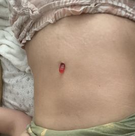 Bellybutton insertions