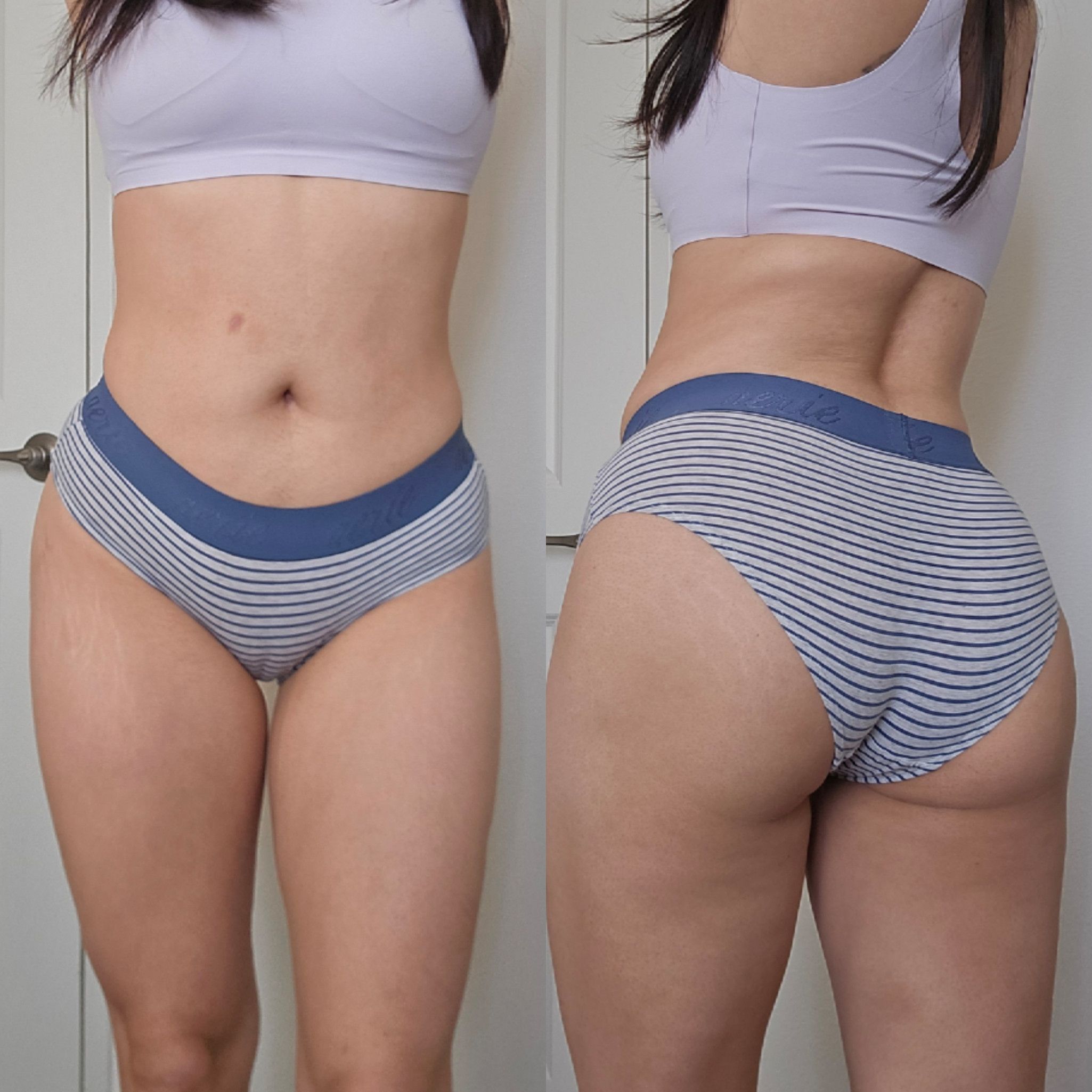 Striped Bikini with Logo Band