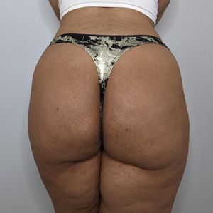 Black n Gold Lace Thong