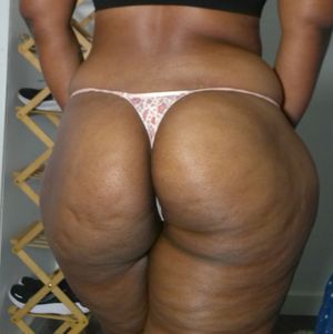 12 Flowery thong