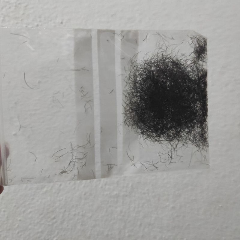 Pussy hair