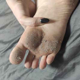 VERY DIRTY FEET PICS