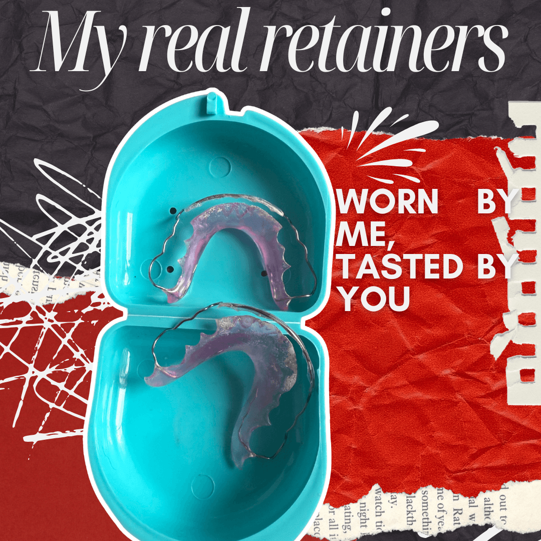 My Real Retainers: A Piece of Me