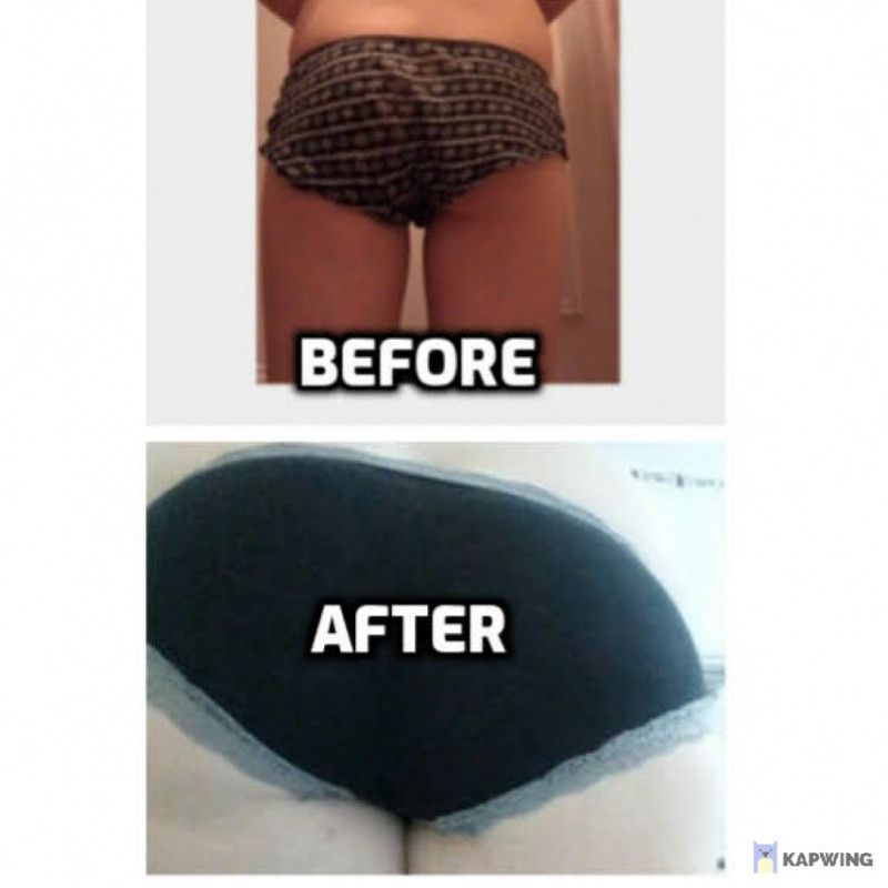 Butt Growth pics 12 photos