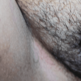 Hairy Pussy