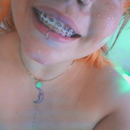 2: cosplay elf braces black mouth