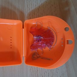 Dental Retainer