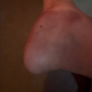 Swingitslim Right Foot showing off