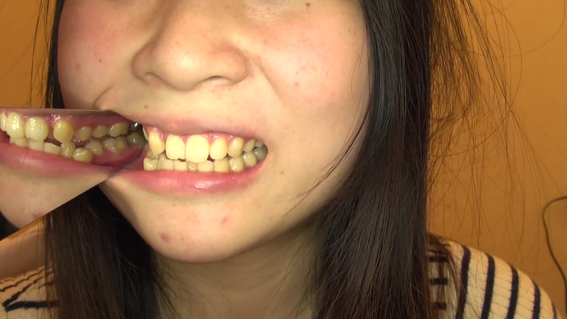 Tooth Fetish by Kusunoki - Part 1