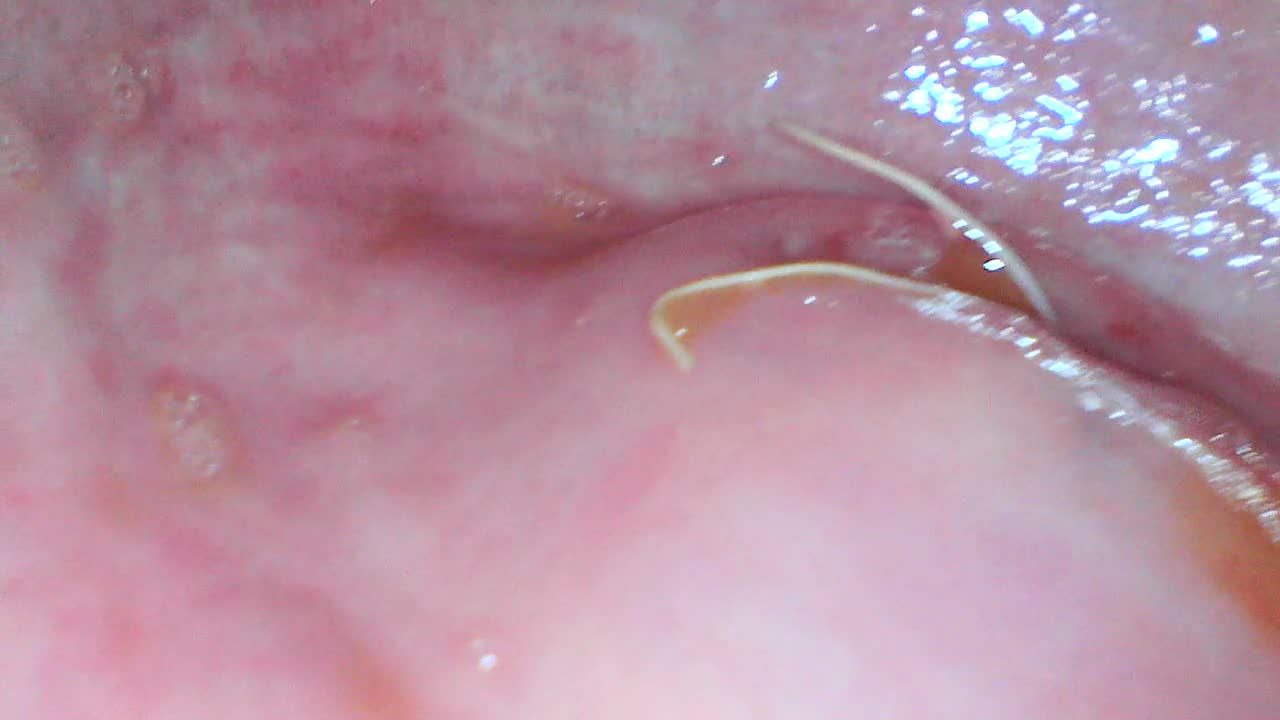 gapig pussy endoscope exploration