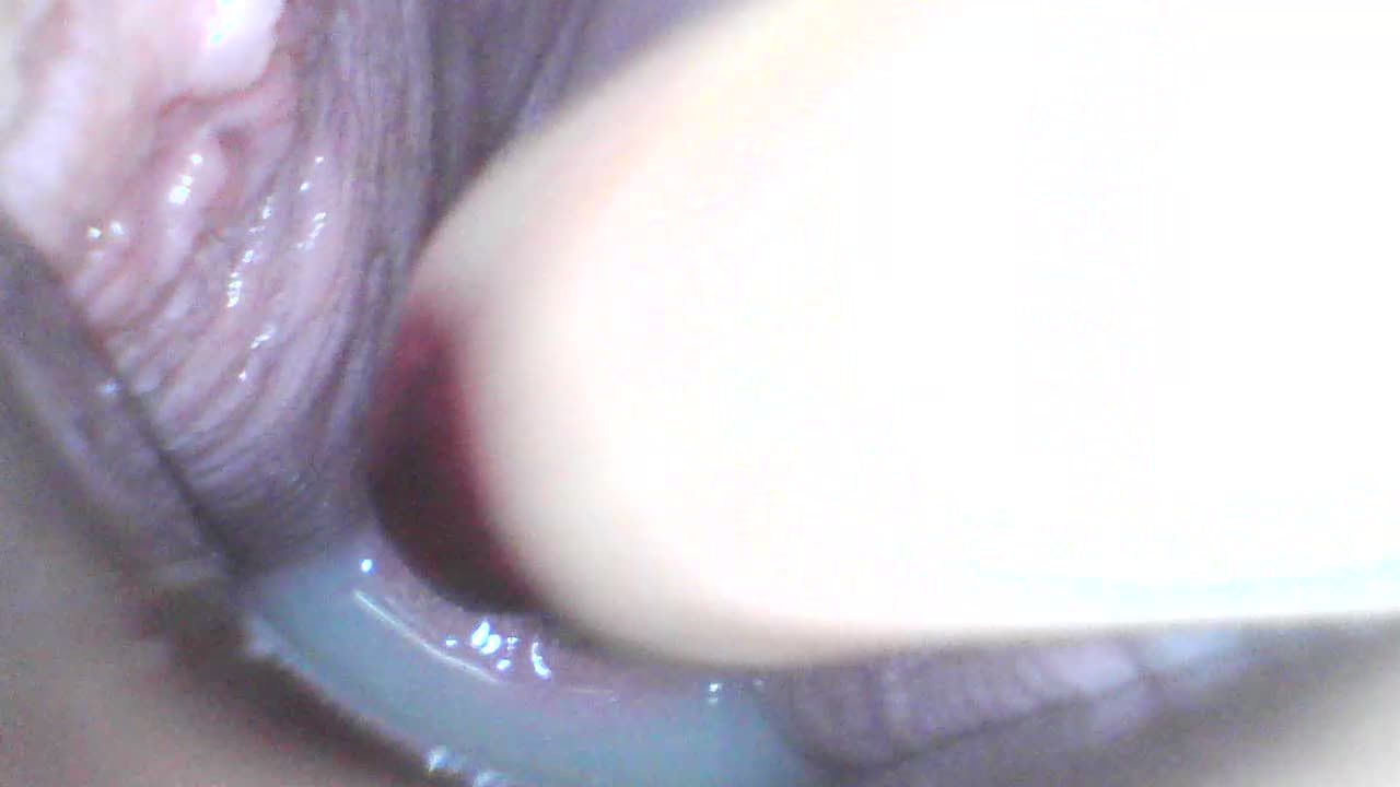 Cervix penetration and speculum