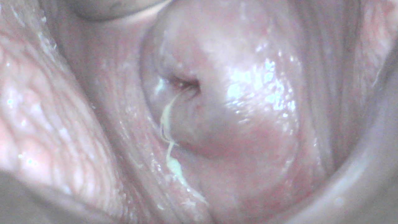 Cervix worship endoscope