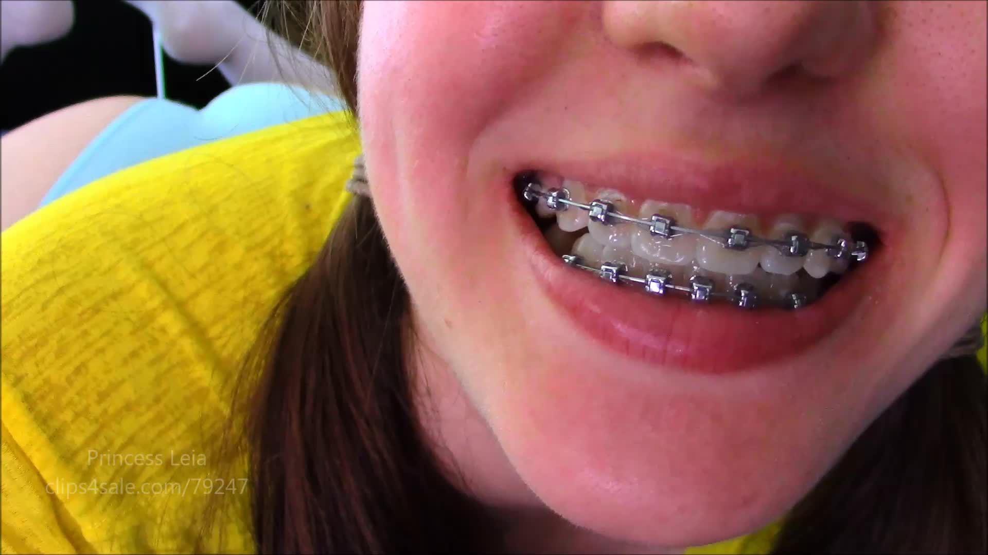 Leias Braces JOI