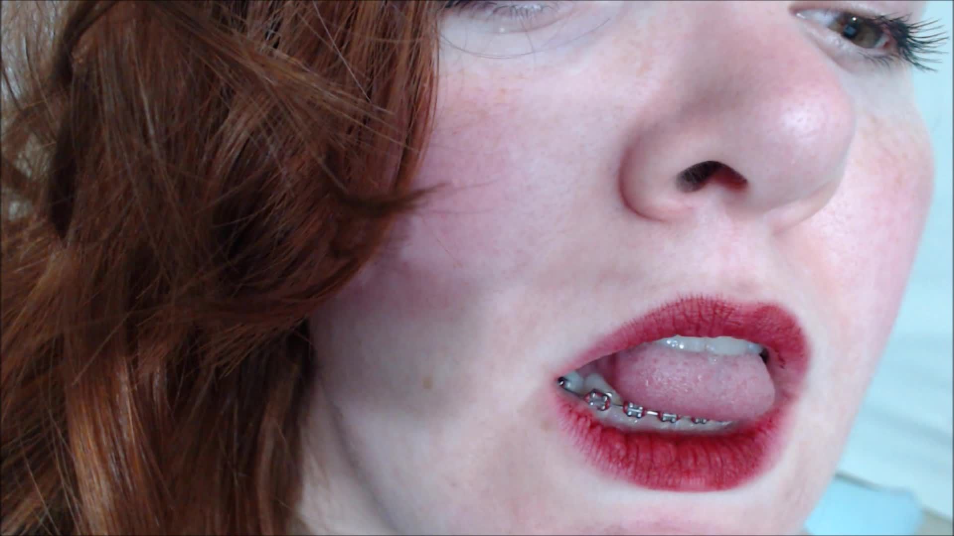 FREE bracesfetish sillyfaces slideshow