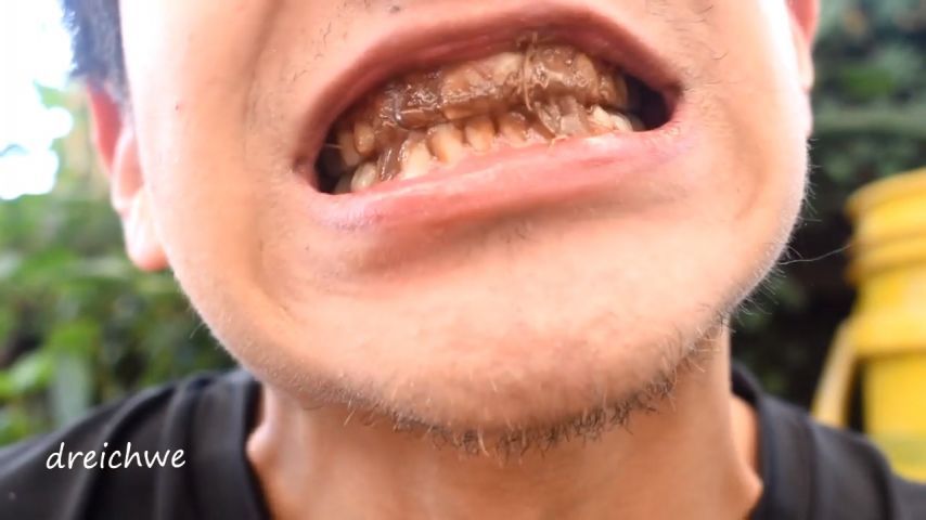 Chocolate on the teeth