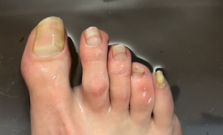 Custom: Long Toenails clipping closeup foot fetish