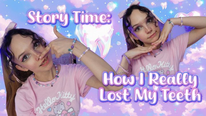 5-Opening Up: How I REALLY Lost My Teeth