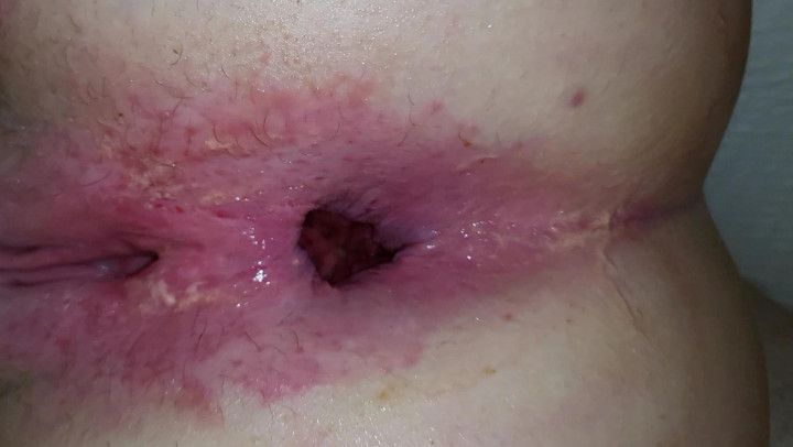 Trucker leaves my asshole gaping