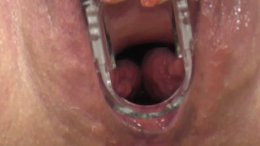 speculum exam look inside my big pussy