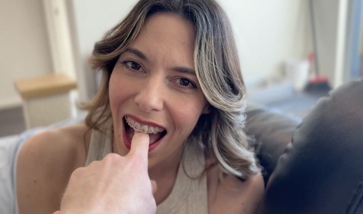 Breaking in My Braces: First Blowjob