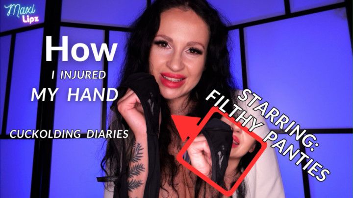 CUCKOLDING DIARIES: How I Injured My Hand