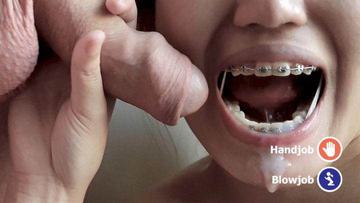 Asian w/ braces elastic sucks uncut cock