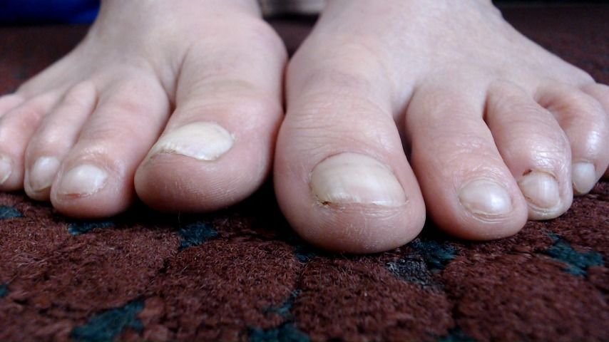 Natural Toe Closeup