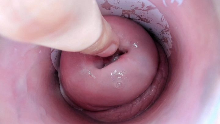 Look Inside my Cervix
