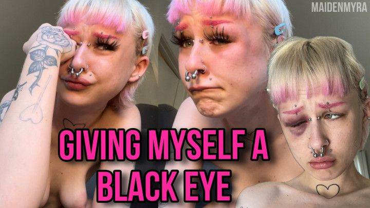 GIVING MYSELF A BLACK EYE