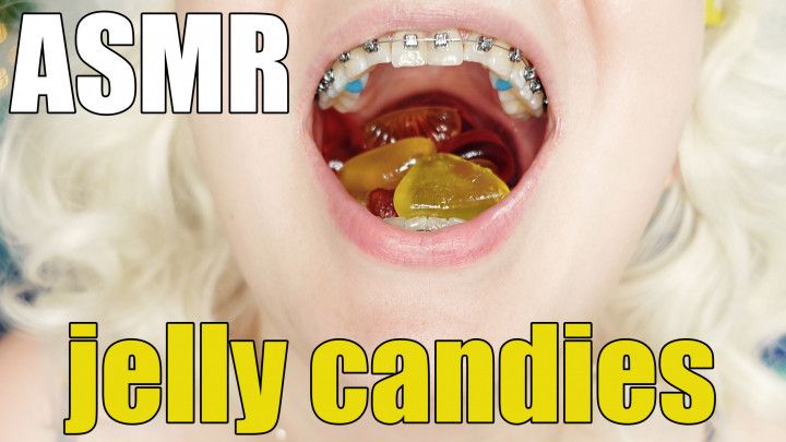 Chewing with braces fetish