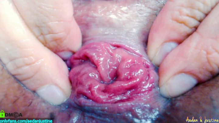 Big anal gapes &amp; rose prolapse by Aedanjustine