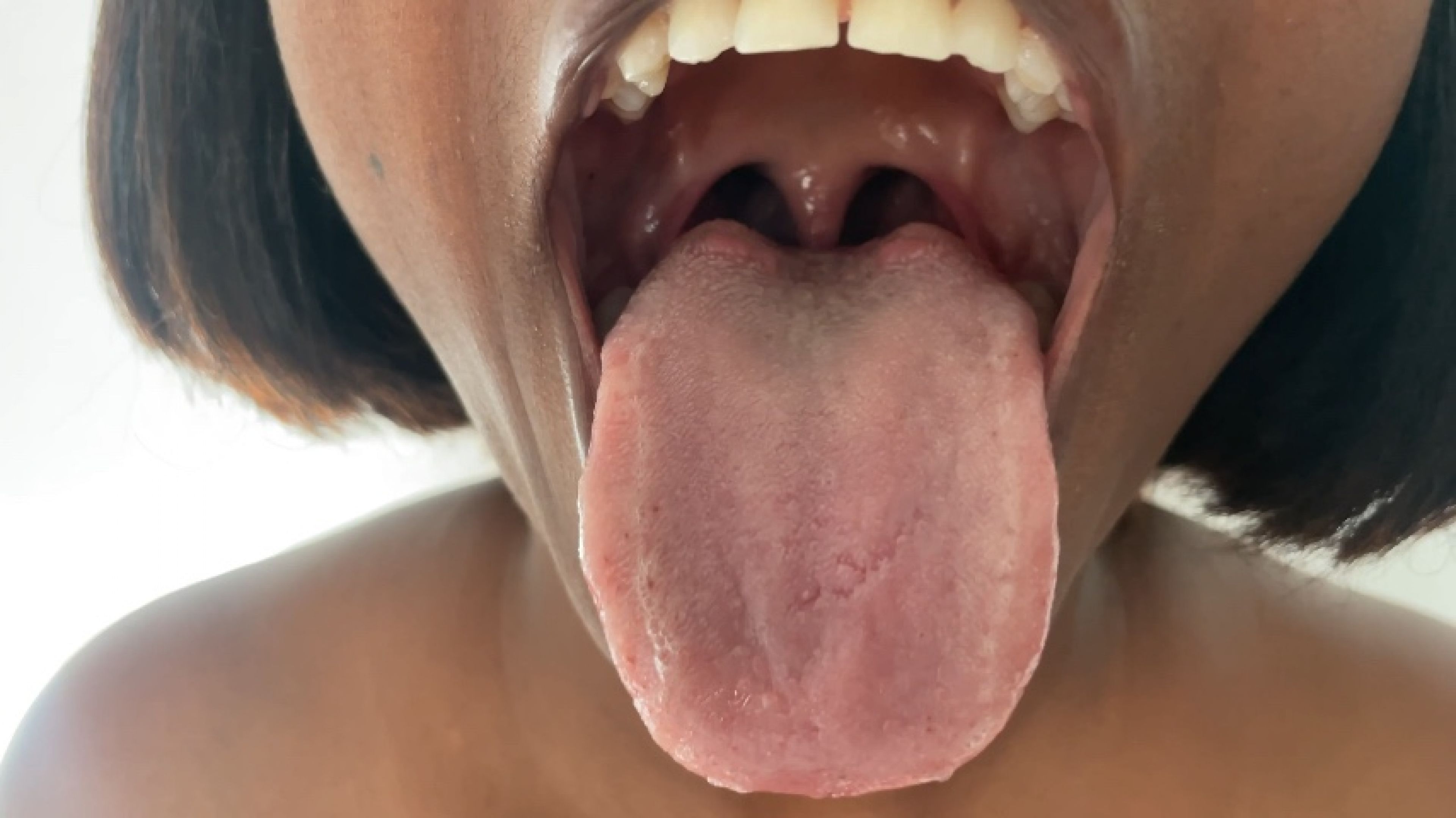 Get a look inside my whole mouth