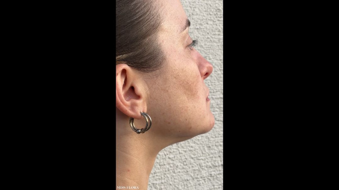 Exercising My Jaw Muscles