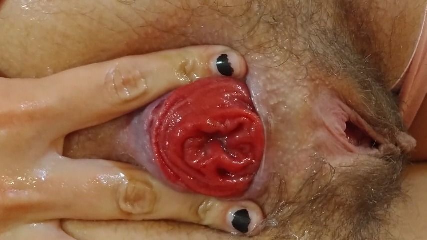 PROLAPSE COMPILATION