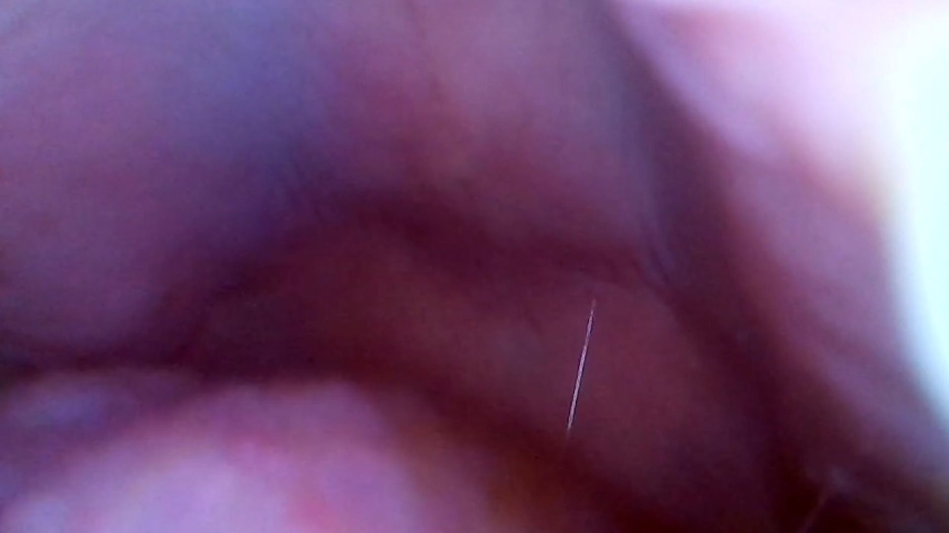 Will Tiny Human Escape being Swallowed