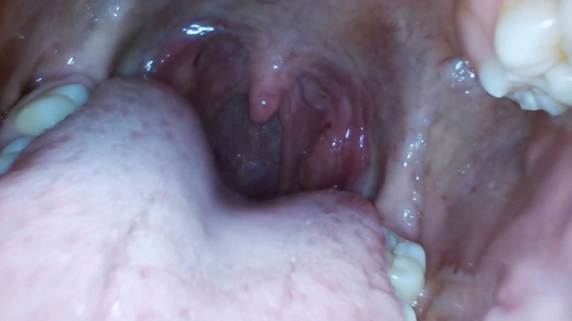 Exploring our mouths with my friend endoscopic camera