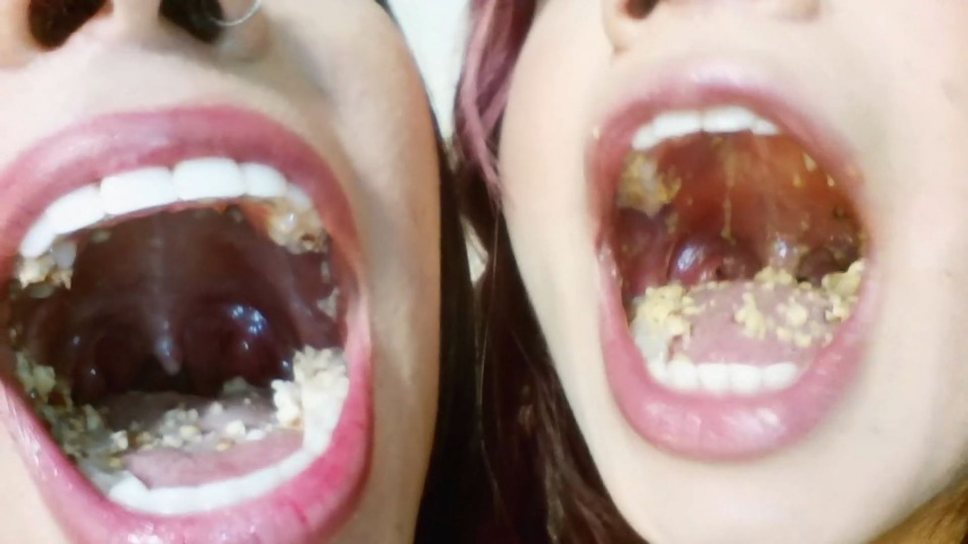 Endoscopic camera eating snacks with my friend