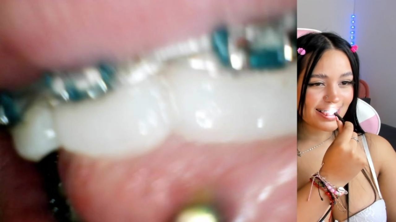 Endoscopic camera - mouth fetish