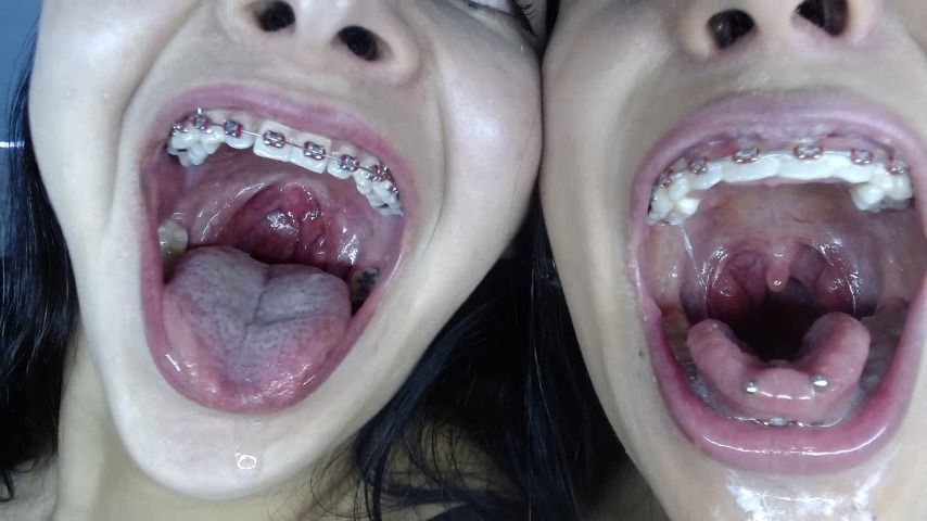 Uvula fetish and Saliva. Braces