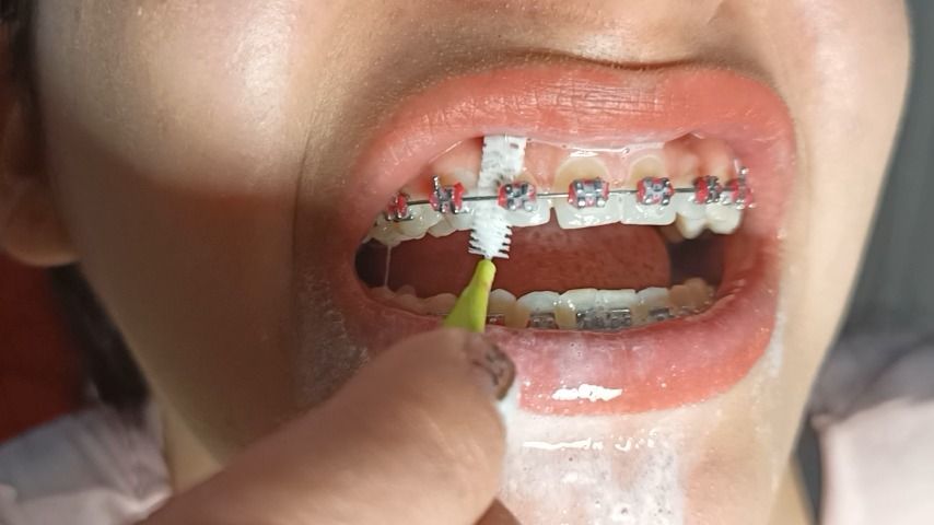 Tooth brushing ASMR