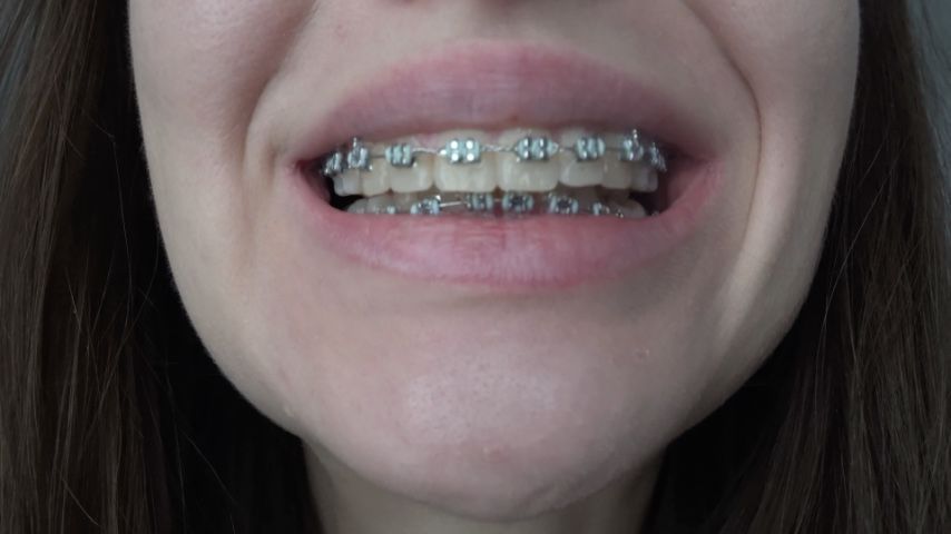 Video screenshot