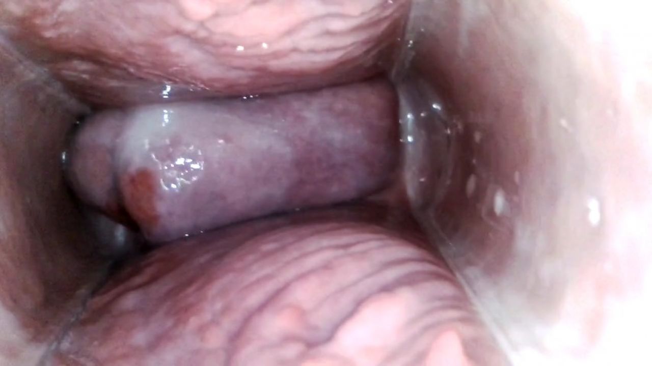 Endoscopy inside my open pussy